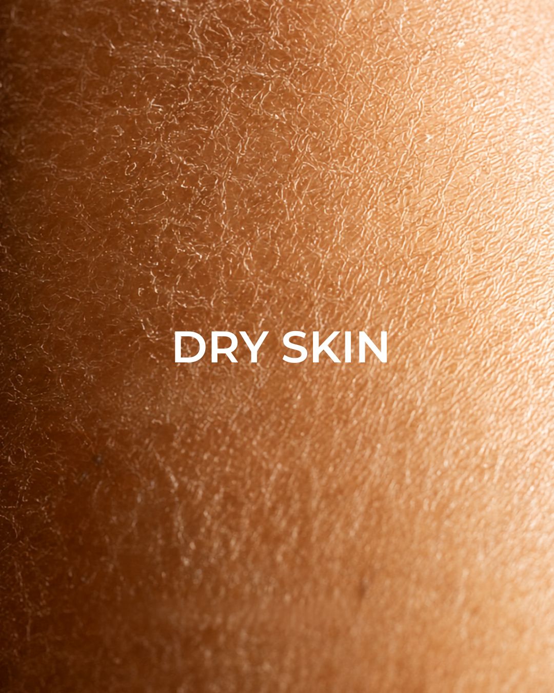 Is Your Skin Dry or Dehydrated?