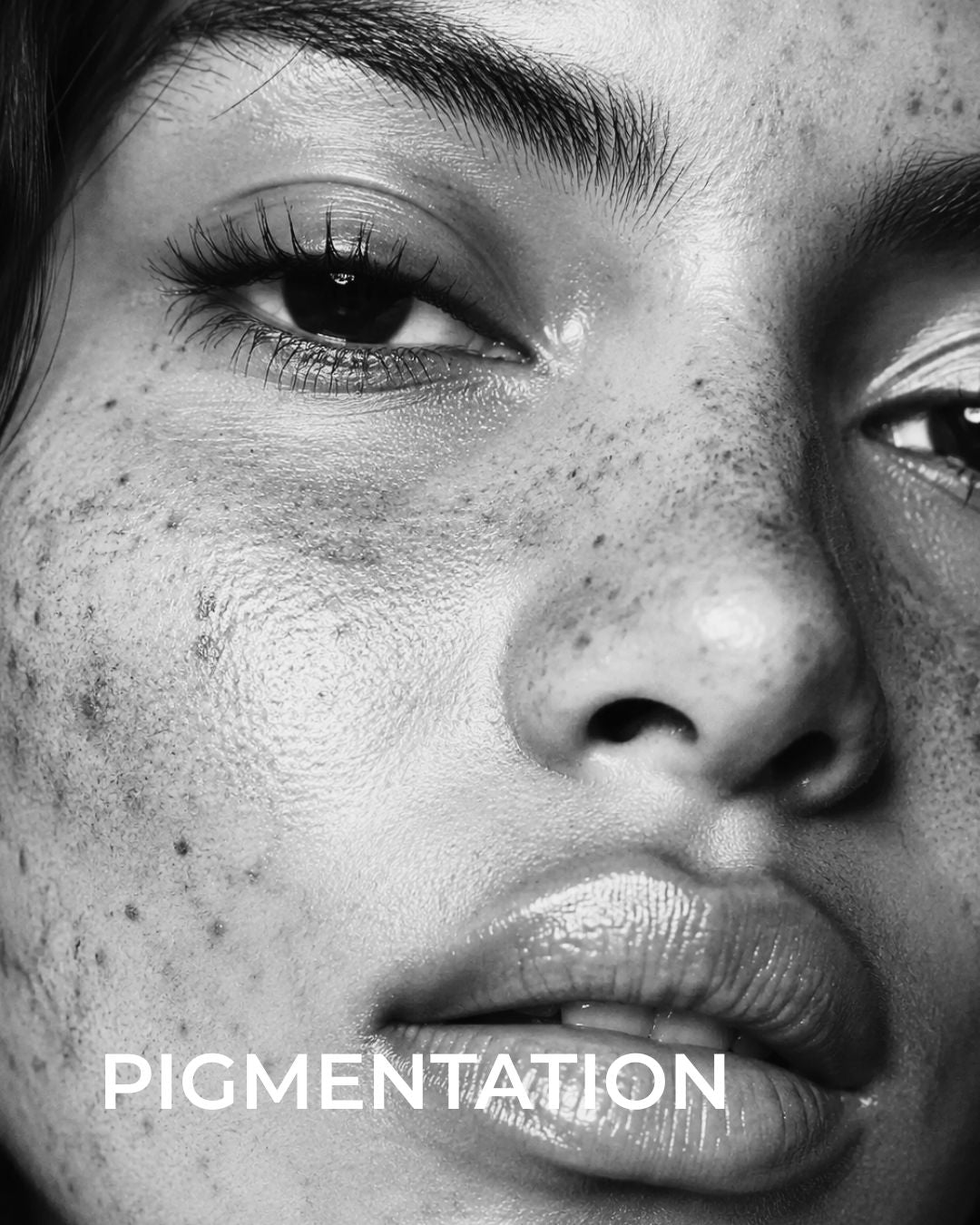Why Dark Spots Keep Coming Back?